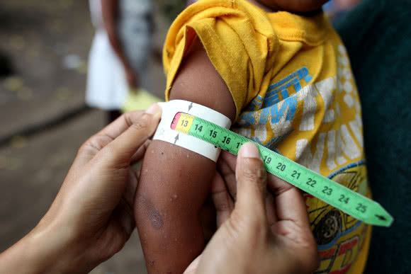 If children show signs of malnutrition, they recieve supplementary feeding to help them recover quickly.